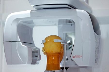 Why Choose CBCT Scans for Dental Exams
