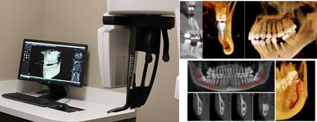 Reasons to Buy Refurbished Dental Imaging Equipment